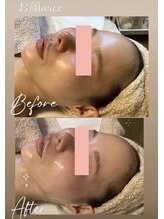 ソラ 六本松店(SORA)/お顔Wax