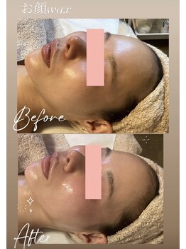 ソラ 六本松店(SORA)/お顔Wax