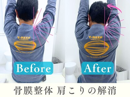 ヒラメント 亀戸院(Hilament)の写真