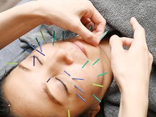 エンビューティー(EN beauty)の雰囲気（美容鍼も完全個室でご案内♪女性鍼灸師おります！）