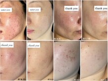 リコ(Lico)の雰囲気（お客様との信頼関係を大切にします。2人3脚で肌質改善へ導きます）