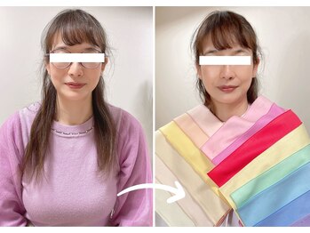 エピファニー 東京 銀座/ビフォーアフター50代(Y.H様)