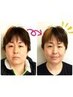 ★小顔人気NO１☆【3D小顔矯正】頭蓋骨矯正+小顔矯正+骨盤矯正SET！¥1980