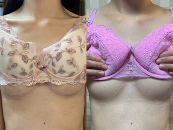 ハレオラ(HaleOla)/お客様の変化☆バストケア