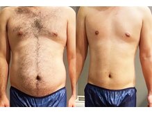 アネル 美里店(anel)/