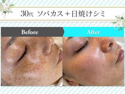 グランシス 水戸店の写真