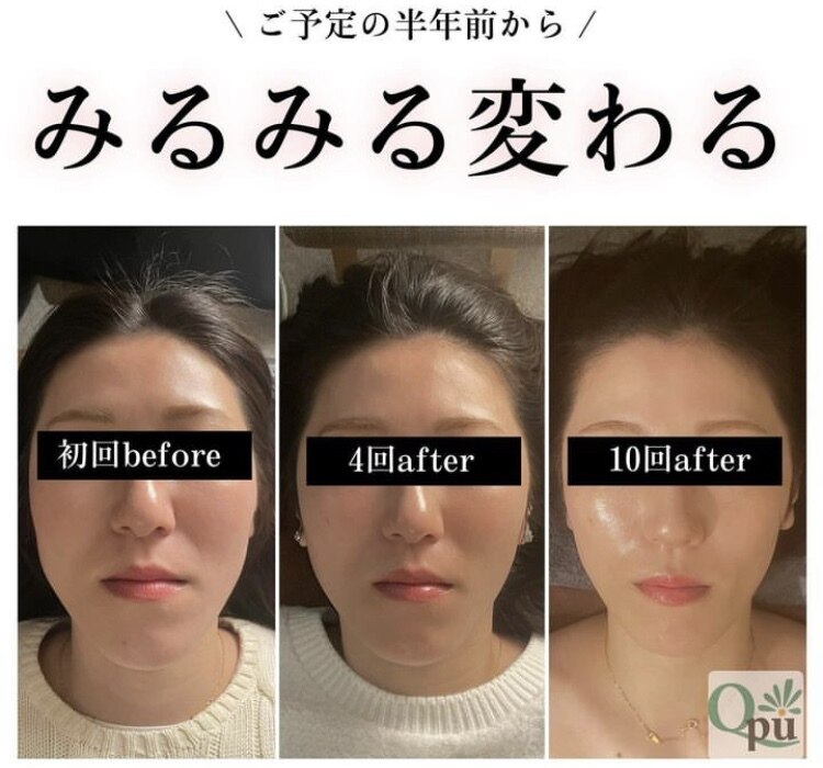 VFアジャスター‼️整体✨美容✨マッサージ✨小顔矯正✨頭蓋矯正 VFアジャスター‼️整体✨美容✨マッサージ✨小顔矯正✨頭蓋矯正 【公式