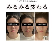キュープ 浜松店(Qpu)