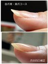 自爪育・美爪コース