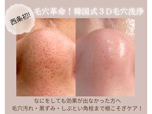スリーナイン ビュウ(3Nine BEAU)の雰囲気（SNSで話題の韓国式3D毛穴洗浄が西条初上陸！毛穴のお悩み解決♪）