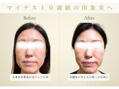 アロハ(ALOHA.)の写真