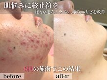 エステサロン ジョアアンジェ(joie ange)