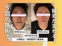 ルルラボ(LuLu beauty labo)/自信が持てる小顔ラインへ！