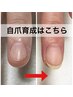 【短い爪を縦長の爪に】☆新春特別価格☆長さを出さずに自爪育成。