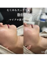 イロハ(IROHA)/施術前後◎