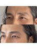 【美眉WAX＋間引き】印象を整える｜似合わせ眉（メイク付）