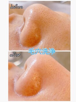 ペルシャイン(Per schein)/毛穴洗浄♪