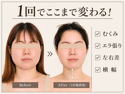ルース(LUCE)の写真