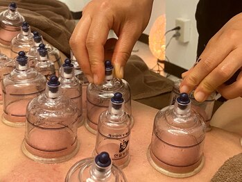 リラスパ 駒生店(RELAXSPA)/カッピング