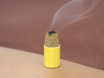 ゆり鍼灸院/お灸施術の筒灸