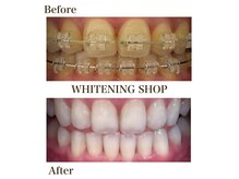 ホワイトニングショップ 川之江店の雰囲気(ホワイトニングショップ【before→after】)