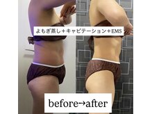 サロンインプルーヴ(Salon improve)の雰囲気（キャビ&業務用EMSで夏までにダイエット）