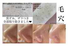 ジュエルオーキッド(Jewel orchids)