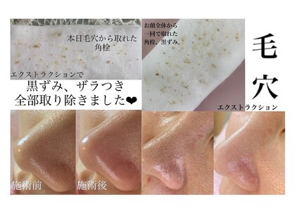 ジュエルオーキッド(Jewel orchids)の写真