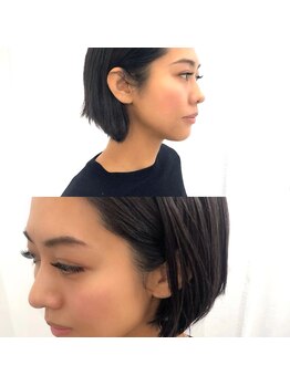 アンドラッシュ アンドネイル 本郷三丁目駅前店(and lash/and nail)/［ボリュームラッシュ］