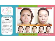 小顔整体研究所 KSラボ 金沢長坂店/比較写真