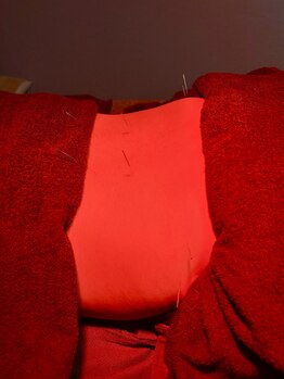 はりめぐり/腰の鍼