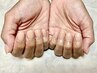 【120分見た目改善】人工爪深爪改善120分￥14300→¥13800