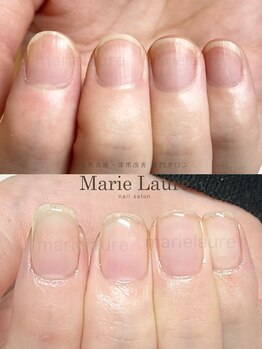 マリーロール 淀屋橋本店(Marie Laure)/自爪育成/深爪矯正/ネイルケア
