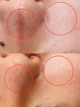 プチ プロムナード(Petit Promenade)/美肌フェイスWax