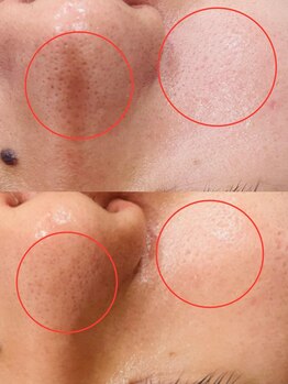 プチ プロムナード(Petit Promenade)/美肌フェイスWax