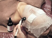 ニコリー(nicoly)/むくみ・エラ・二重あごスッキリ