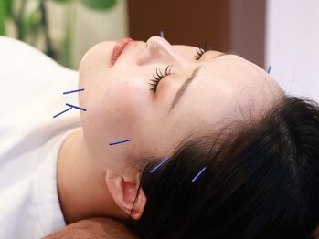 コハルはり灸整骨院(koharuはり灸整骨院)の写真/未来の肌を育てる美容鍼◎年齢を感じさせない素肌へ◆自然にハリ&ツヤUP!血流改善でくすみゼロのお肌へ♪