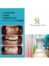 ライズビューティーサロン(Rise Beauty Salon)/☆ビフォーアフター☆