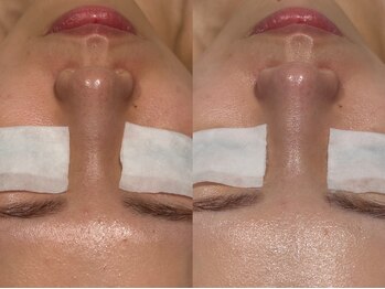 フロムミー 銀座本店(FROM ME)/ブラックモッチ