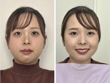 シュシュビエン(Chou Chou Bien)/一押しトータル診断フルメイク♪