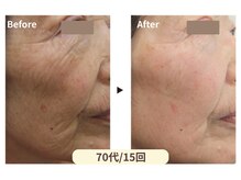 美男美女 奈良三条店/深いシワも怖くない