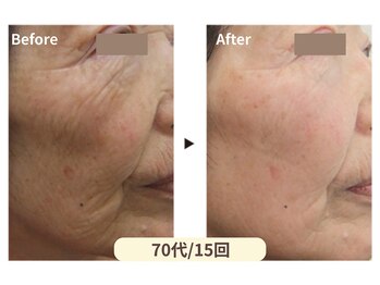 美男美女 奈良三条店/深いシワも怖くない