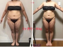 オージャス(OJAS)/40代○○様の変化　痩ボディーへ