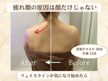 ミスティア(mistia)