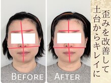 スウ(suu.)/Before-After【40代】1回