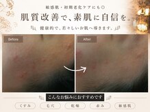 オーガニック アンド ビューティー シアン(CYAN.)の雰囲気（【スタンダードコース】ビフォーアフター1回　20代）