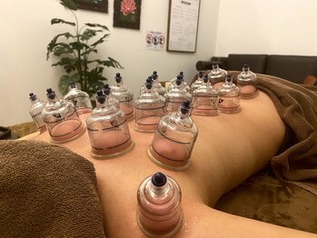 リラスパ 駒生店(RELAXSPA)/オイルカッピング