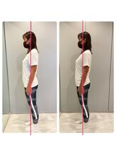 エーピラティス 美生体研究所(A pilates)/初回1回のみの姿勢変化(^^)