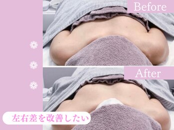キアナ 横浜店(Kiana)/左右差にお悩みの方Before After