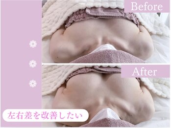 キアナ 横浜店(Kiana)/左右差にお悩みの方Before After